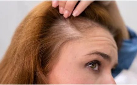 टूटते-झड़ते बालों का कारण, आपकी ये आदतें, जल्द कर लें सुधार