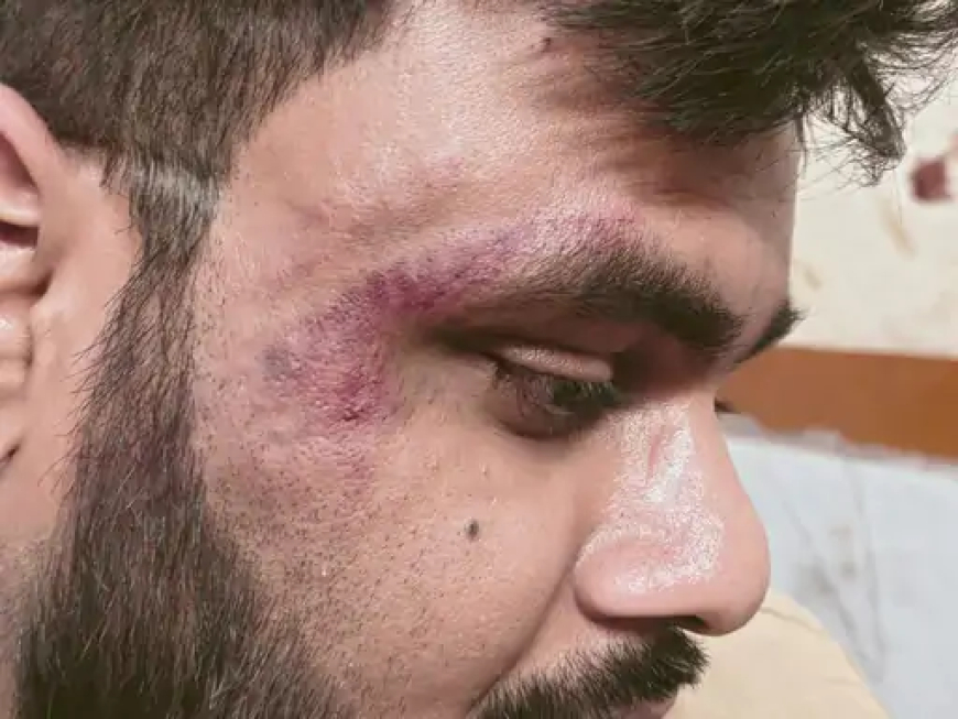 कोरबा जिले में गेवरा दीपका स्थित नेहरू शताब्दी अस्पताल (NCH) गेवरा के चिकित्सक डॉ. अर्पण विश्वास पर सोमवार को हमला किया गया