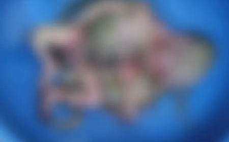 छत्तीसगढ़ के बालोद जिले के दल्लीराजहरा के शहीद हॉस्पिटल के डिलीवरी वार्ड के बाहर शौचालय की टॉयलेट सीट में नवजात भ्रूण मिला