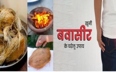 Piles Treatment: बिना चीरे और टांके सिर्फ 3 दिन में गिर जाएंगे मस्से, राजस्थानी वैद्य ने बताया खास राख वाला नुस्खा