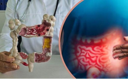 बार-बार एसिडिटी और खट्टी डकारों को न करें नजरअंदाज, ये हो सकते हैं पेट के कैंसर का शुरुआती अलार्म