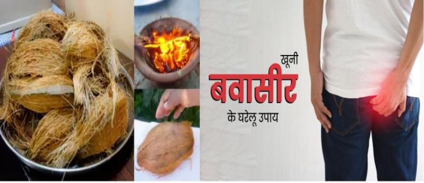 Piles Treatment: बिना चीरे और टांके सिर्फ 3 दिन में गिर जाएंगे मस्से, राजस्थानी वैद्य ने बताया खास राख वाला नुस्खा