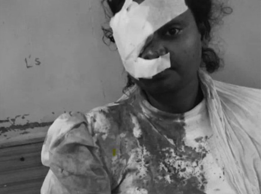 रायपुर के मेट्रो बार में बॉयफ्रेंड ने शराब की बोतल से वारकर अपनी गर्लफ्रेंड का सिर फोड़ दिया