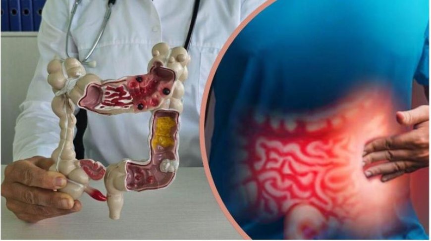 बार-बार एसिडिटी और खट्टी डकारों को न करें नजरअंदाज, ये हो सकते हैं पेट के कैंसर का शुरुआती अलार्म