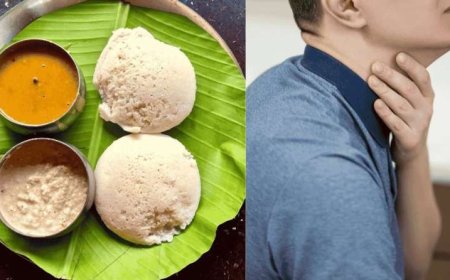 इडली खाते-खाते हुई मौत, खाने में ये गलती पड़ सकती है भारी; डॉक्टर ने बताया बचने का तरीका