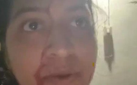 दुर्ग में घर में घुसकर लोहे की रॉड से हमला