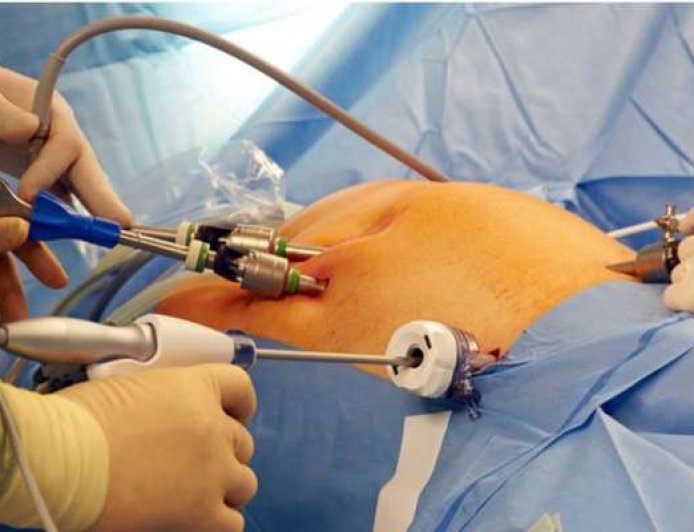 वजन घटाने के लिए बैरिएट्रिक सर्जरी: कितनी सुरक्षित और असरदार, कौन करवा सकता है?