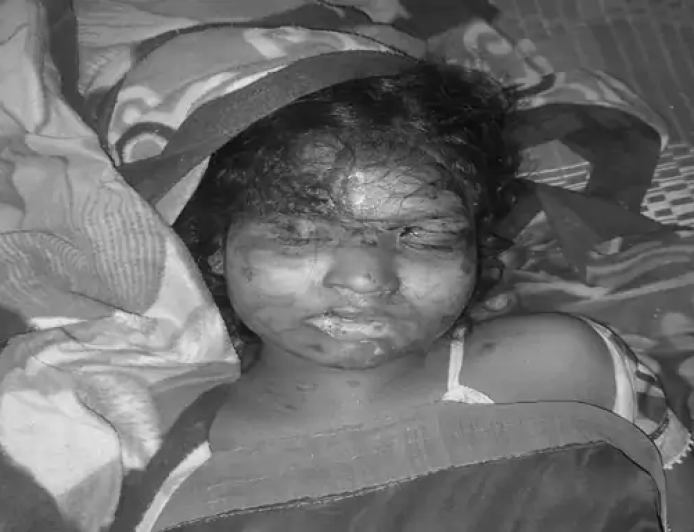 छत्तीसगढ़ के जशपुर जिले में लव मैरिज के 3 साल बाद अच्छी सब्जी नहीं बनाने पर पति ने अपनी प्रेग्नेंट पत्नी को मार डाला