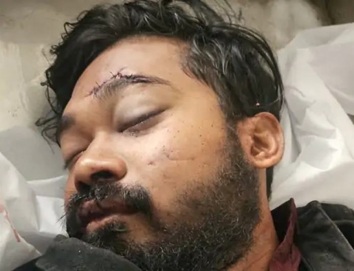 बिलासपुर में जिला कोर्ट के सामने एक सड़क हादसे में तहसीलदार के बेटे की मौत