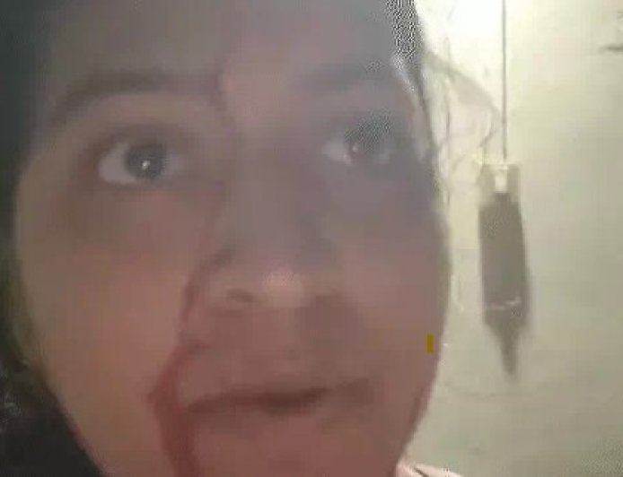 दुर्ग में घर में घुसकर लोहे की रॉड से हमला